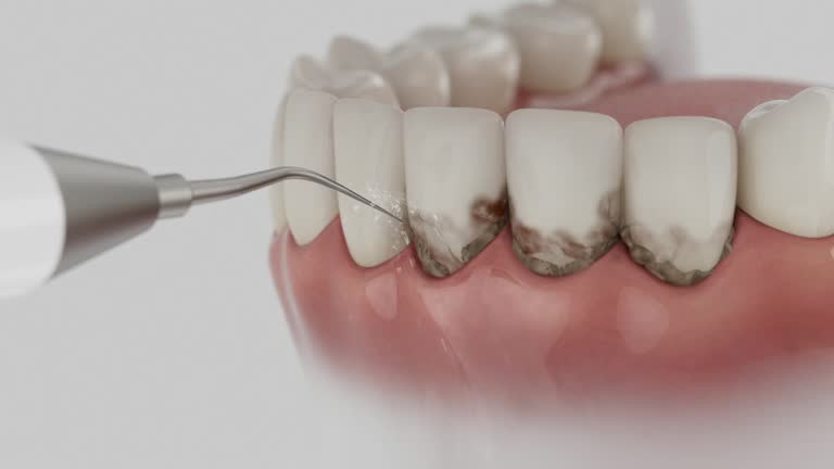 Trusted Tooth Extraction service in Jones, OK - Dentist Open Now